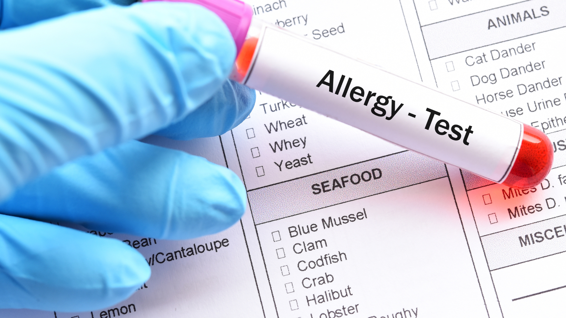 Allergy Test - research on clinical outcomes