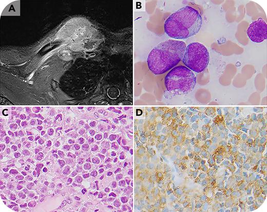 Rare cancer diagnosis by Awanui scientist receives international recognition  