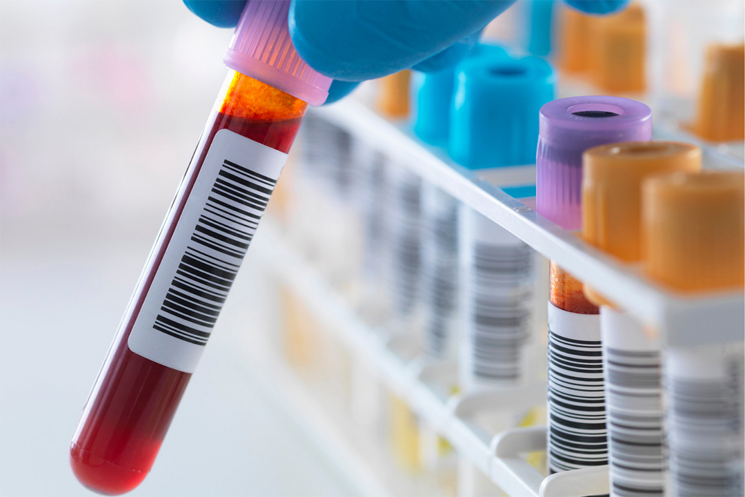 Faster and easier blood testing in Canterbury